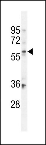 ANTI-BCMO1 (CENTER) antibody produced in rabbit