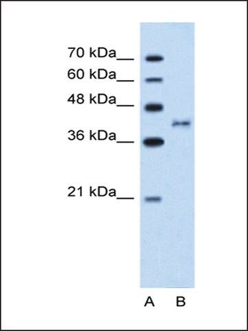 Anti-BDKRB2 antibody produced in rabbit