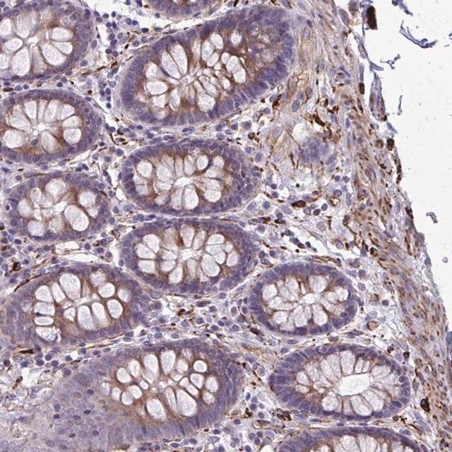 Anti-BEND5 antibody produced in rabbit