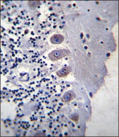 ANTI-BEAN (N-TERM) antibody produced in rabbit