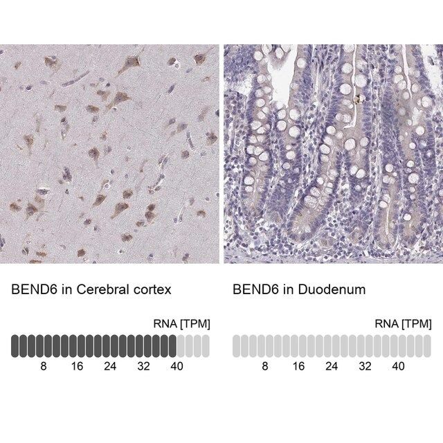 Anti-BEND6 antibody produced in rabbit