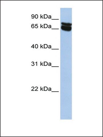 Anti-B4GALNT1 antibody produced in rabbit