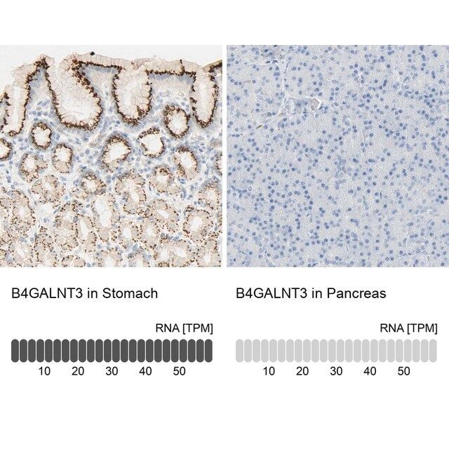 Anti-B4GALNT3 antibody produced in rabbit