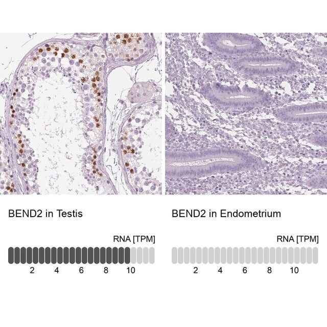 Anti-BEND2 antibody produced in rabbit