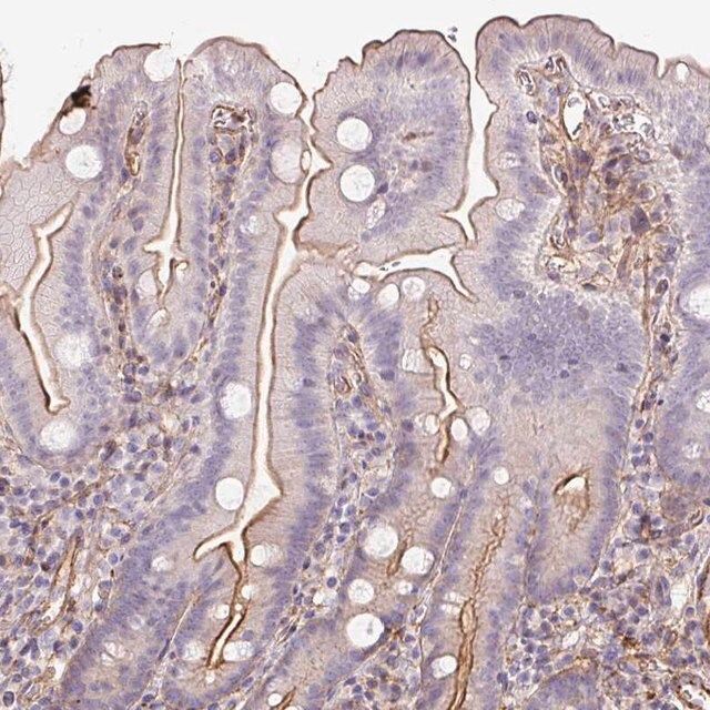 Anti-B3GALT5 antibody produced in rabbit