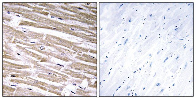 Anti-B3GALT2 antibody produced in rabbit