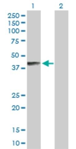 Anti-B4GALNT1 antibody produced in rabbit