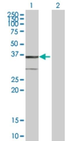 Anti-BDH1 antibody produced in mouse