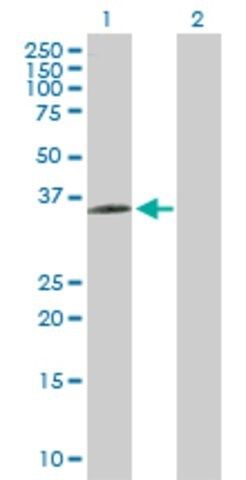 Anti-BDKRB1 antibody produced in rabbit