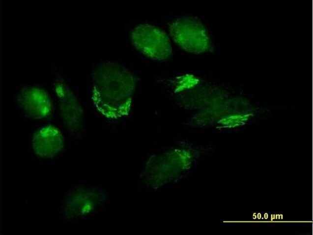 Anti-B4GALT4 antibody produced in mouse