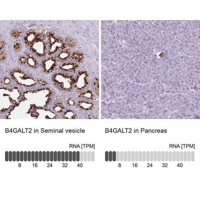 Anti-B4GALT2 antibody produced in rabbit