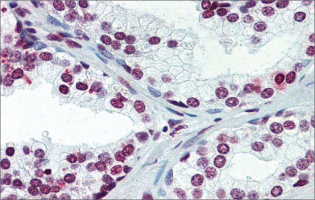 Anti-ARID5A (ab2) antibody produced in rabbit