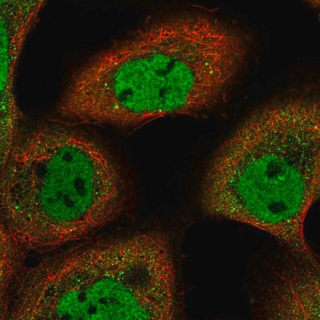 Anti-ARMC8 antibody produced in rabbit