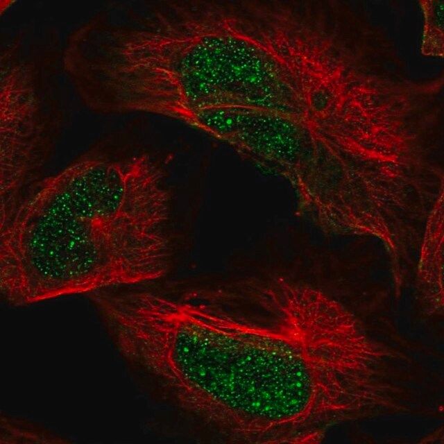 Anti-ARID2 antibody produced in rabbit