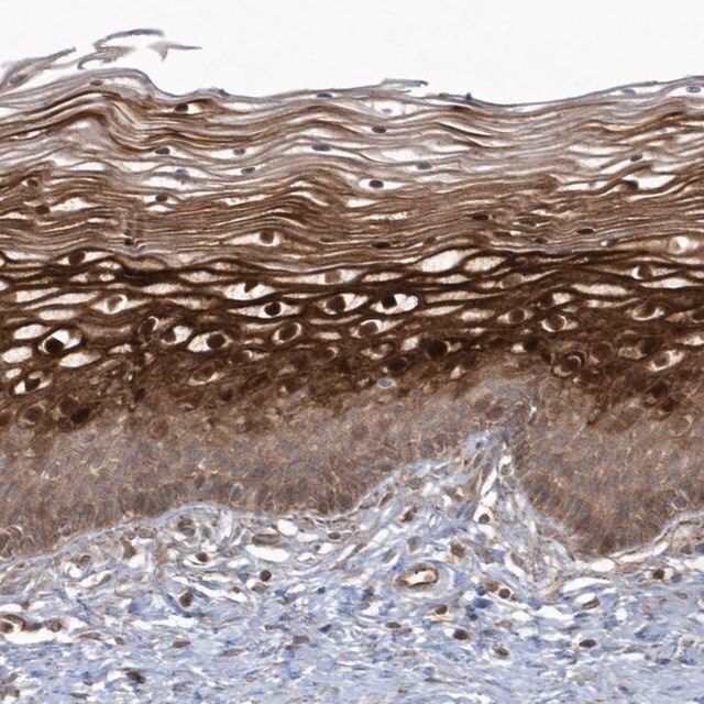 Anti-ARMC8 antibody produced in rabbit