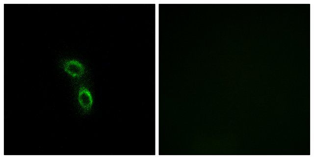 Anti-ARMC6 antibody produced in rabbit