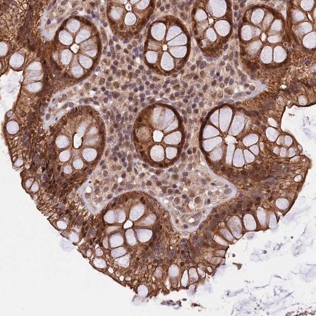 Anti-ARL14EP antibody produced in rabbit