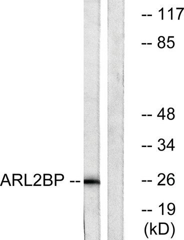 Anti-ARL2BP antibody produced in rabbit