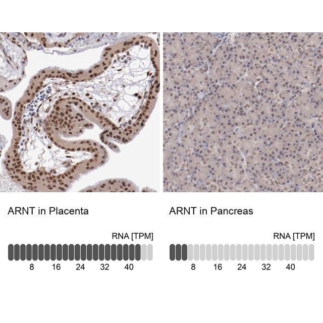 Anti-ARNT antibody produced in rabbit