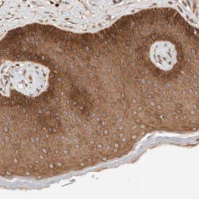 Anti-ARMC9 antibody produced in rabbit