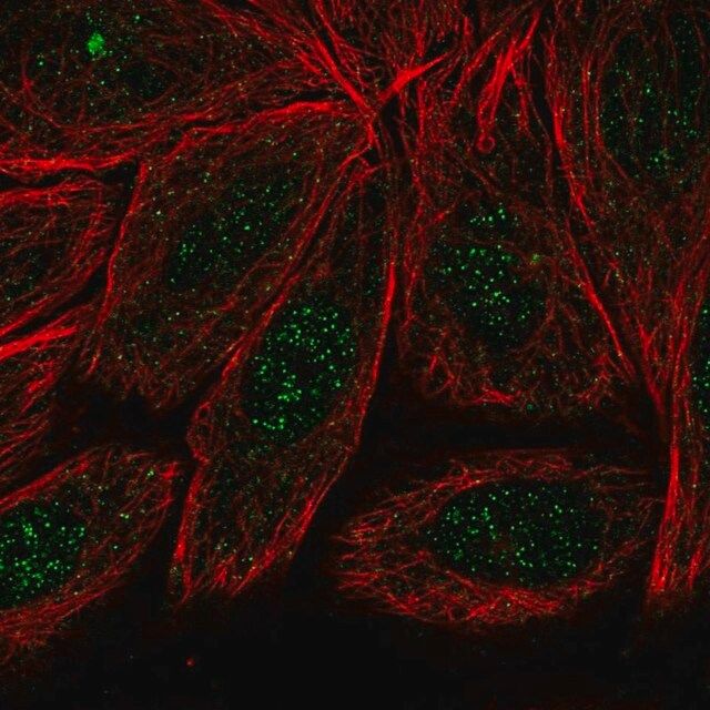 Anti-ARMC2 antibody produced in rabbit