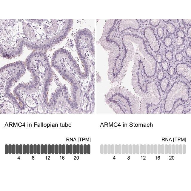 Anti-ARMC4 antibody produced in rabbit