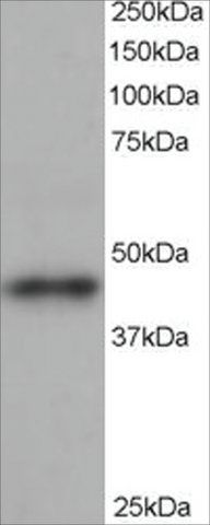 Anti-ARP1 homolog B antibody produced in goat