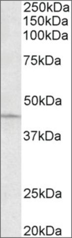 Anti-ARPC1A (C-terminal) antibody produced in goat