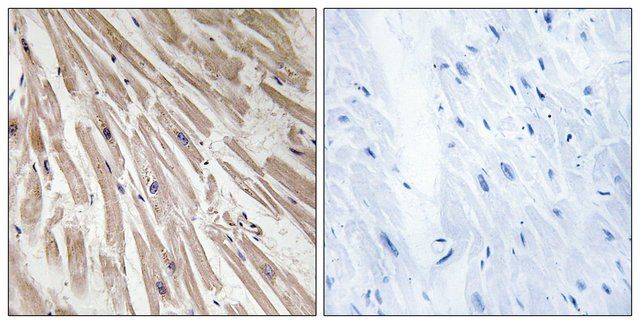 Anti-ARPP21 antibody produced in rabbit