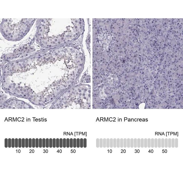 Anti-ARMC2 antibody produced in rabbit