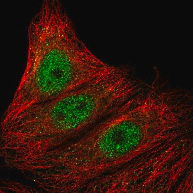 Anti-ARMC5 antibody produced in rabbit