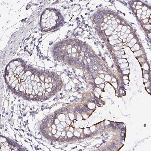 Anti-ARL4D antibody produced in rabbit