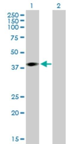 Anti-ARPM1 antibody produced in mouse