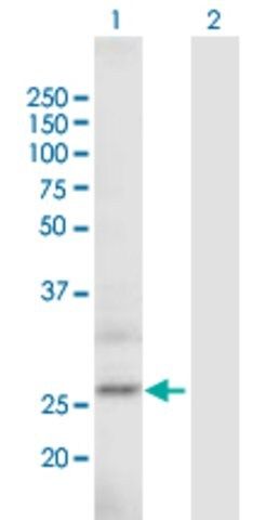 Anti-ARPC5L antibody produced in mouse