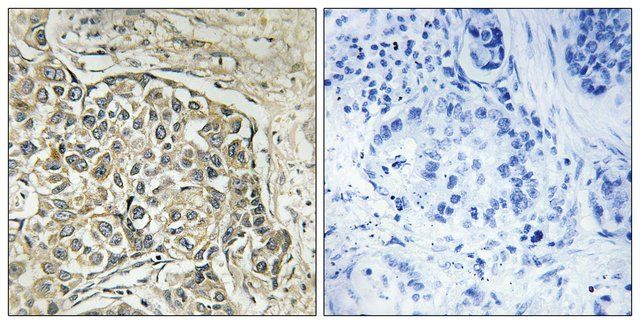 Anti-ARSD antibody produced in rabbit