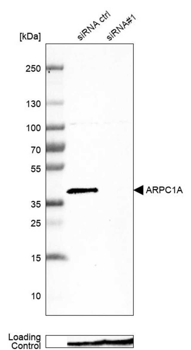 Anti-ARPC1A antibody produced in rabbit