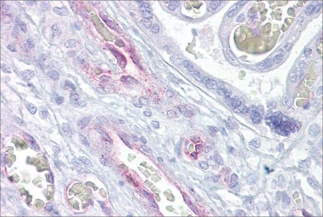 Anti-ARNTL2 antibody produced in rabbit