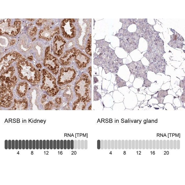 Anti-ARSB antibody produced in rabbit