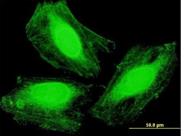 Anti-ARMC1 antibody produced in mouse