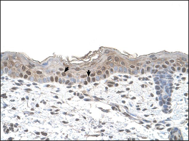 Anti-ARRB2 antibody produced in rabbit