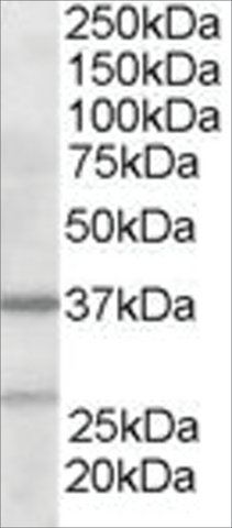 Anti-ARP2/3 subunit 1B antibody produced in goat