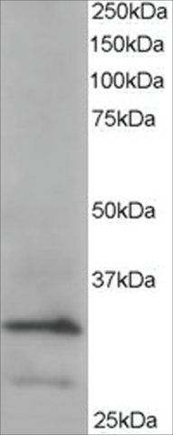 Anti-ARPC2 antibody produced in goat