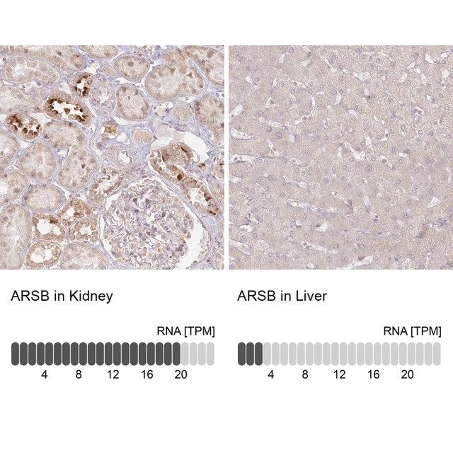 Anti-ARSB antibody produced in rabbit