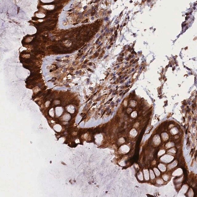 Anti-ARRDC4 antibody produced in rabbit