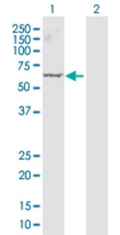 Anti-ARRB1 antibody produced in rabbit