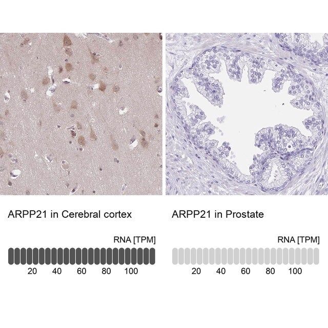 Anti-ARPP21 antibody produced in rabbit