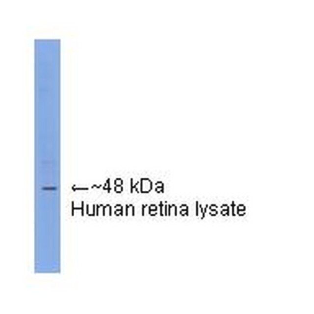 Anti-Arrestin Antibody, visual