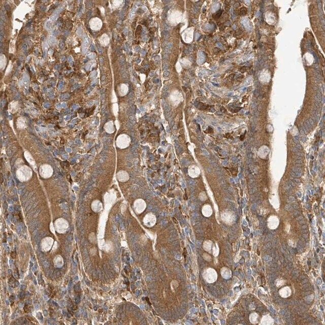 Anti-ARPIN antibody produced in rabbit