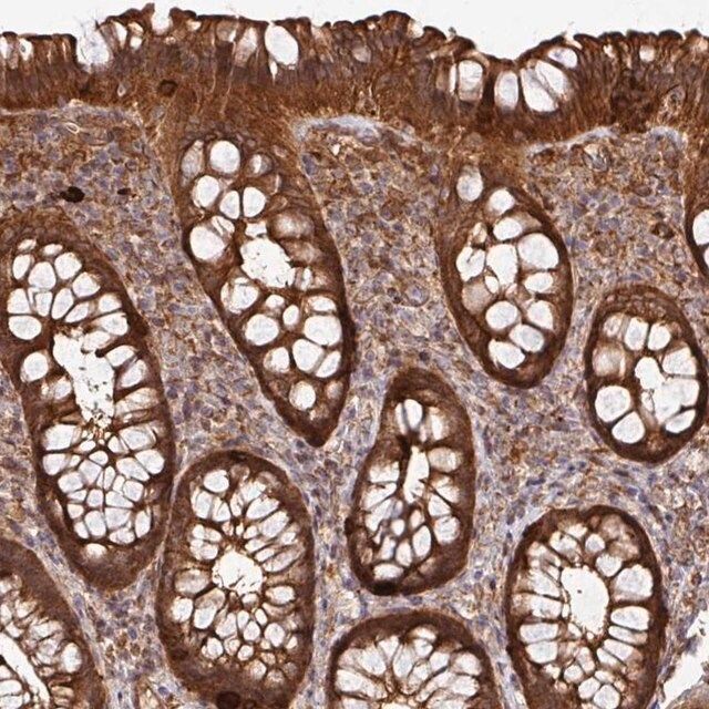 Anti-ARPIN antibody produced in rabbit