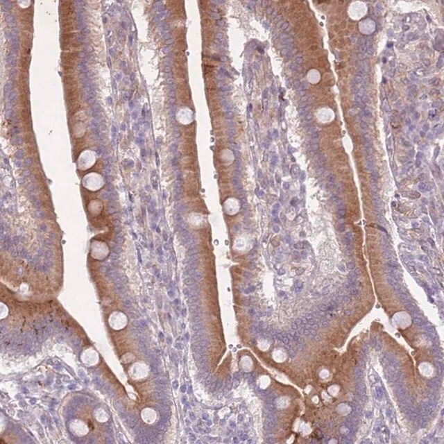 Anti-ARPIN antibody produced in rabbit